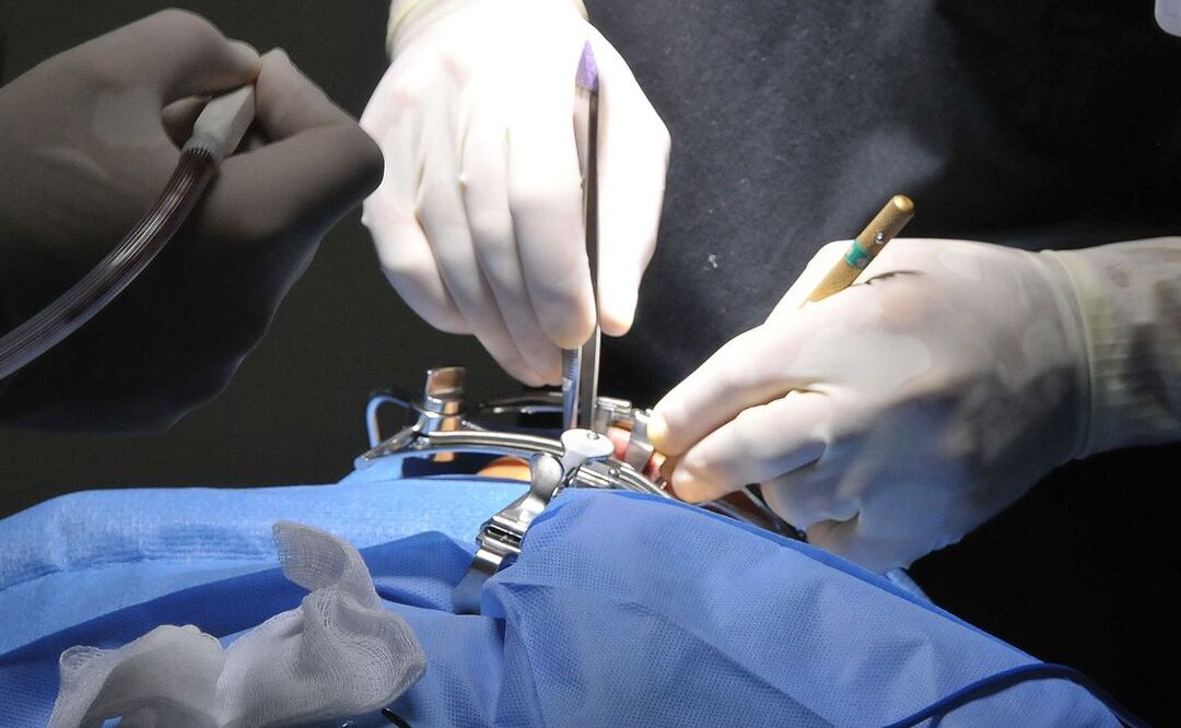 Negligencias han acabado con la vida de mujeres que se hicieron liposucción y otros tratamientos | Foto: Agencia Es Imagen para El Universal Puebla