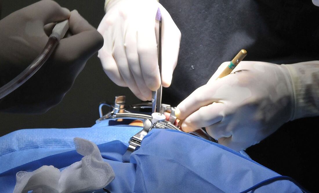 Negligencias han acabado con la vida de mujeres que se hicieron liposucción y otros tratamientos | Foto: Agencia Es Imagen para El Universal Puebla