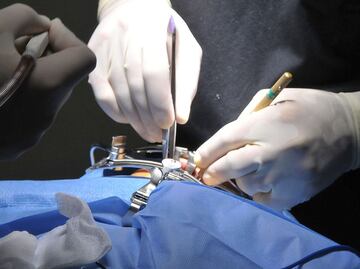 Tratamientos estéticos que salieron mal en Puebla