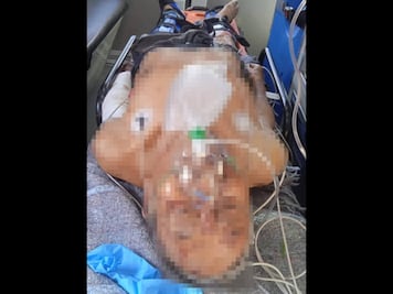 Perros callejeros casi devoran a abuelito en Tlaxcalancingo