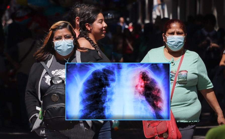 Tambien hay repunte de tuberculosis, Puebla tiene 35 casos