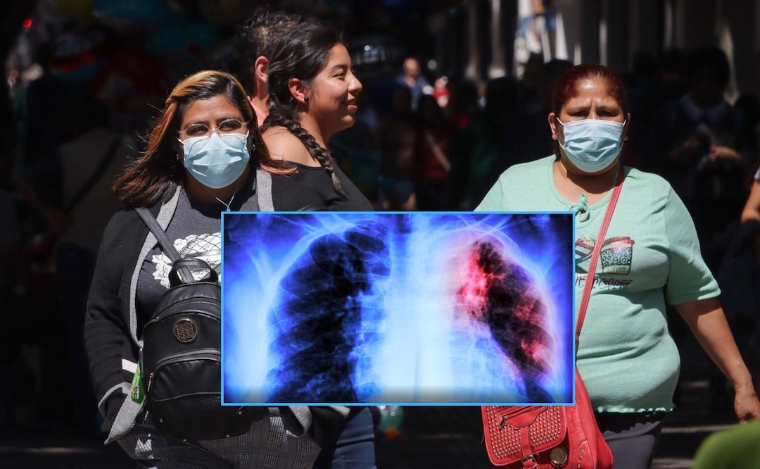 También hay alerta por tuberculosis en México | Foto: EsImagen/Getty Images