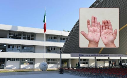 Suspenden clases en escuelas de la ciudad de Puebla e Izúcar por brotes de Coxsackie