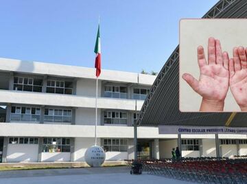 Suspenden clases en escuelas de la ciudad de Puebla e Izúcar por brotes de Coxsackie