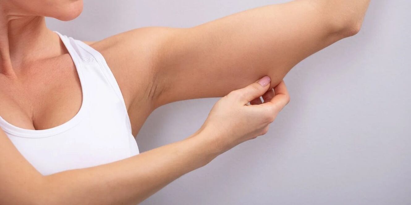 El tiempo que lleva perder el exceso de grasa depende de la constancia, la diligencia a la hora de realizar cambios saludables en el estilo de vida, la genética, la pérdida de peso y la cantidad y tipo de ejercicio. 

Foto: Producción El Universal