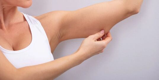 ¿Cuál es la mejor manera de perder grasa en los brazos? Esto dicen especialistas