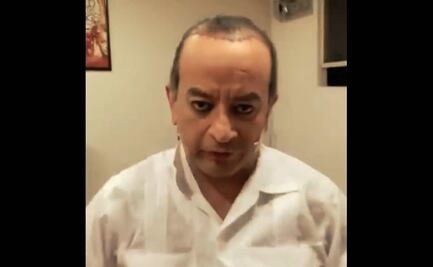 'Ahora sí que me la pelan', afirma Germán Ortega tras someterse a implante capilar