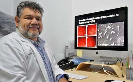 Investigador de la Facultad de Ciencias Biológicas desarrolla biosensores para detectar bacterias patógenas y toxinas