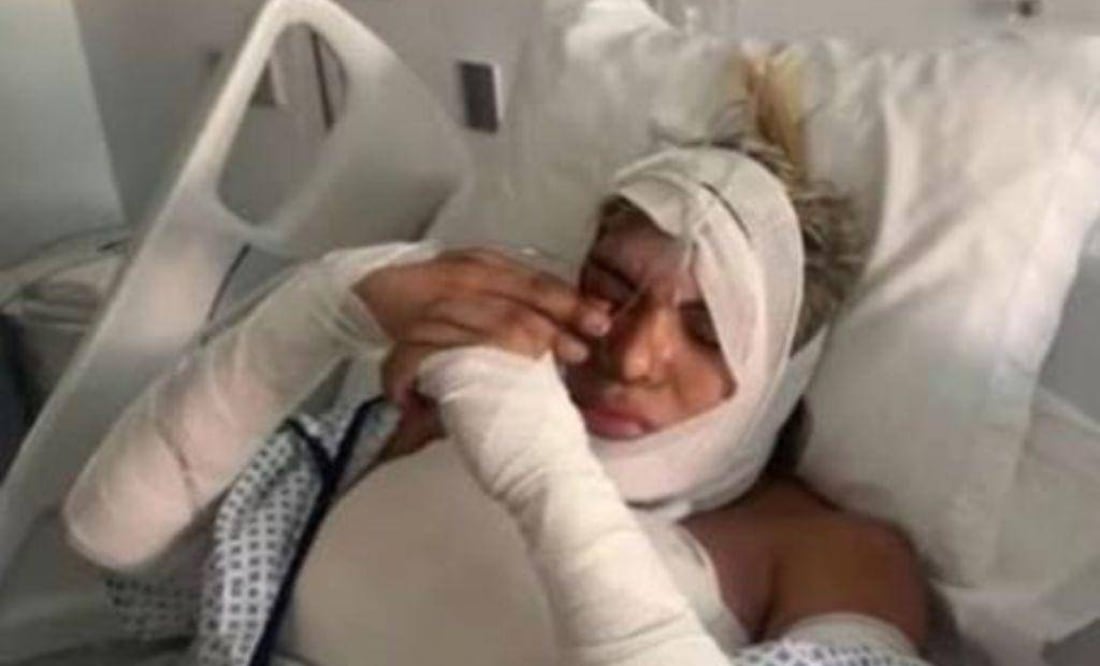 En la transmisión en vivo explicaron un poco sobre la enfermedad que lo llevó a ser operado de emergencia.