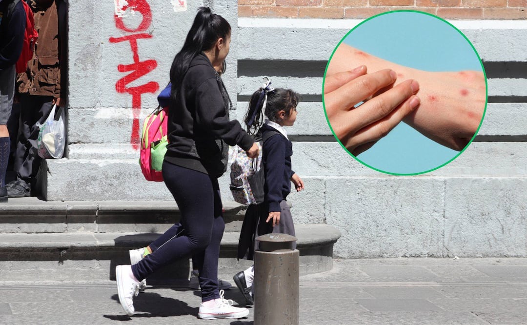 Se han confirmado 44 casos de sarampión en Puebla | Foto: EsImagen/Getty Images