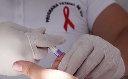 En 2 años de pandemia se han diagnosticado mil 538 casos de VIH en Puebla