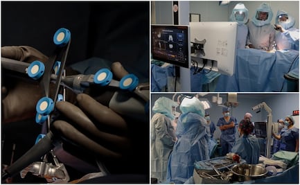 Con apoyo de la IA, ISSSTEP realiza primera cirugía de rodilla