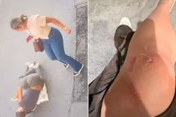 Estos son los "pantalones asesinos" de Zara que lesionan a las compradoras