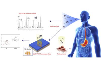 Diseña BUAP sensor para que diabéticos midan la glucosa con su aliento