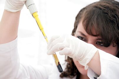 Descartan casos en Puebla de viruela símica alertada por la OMS