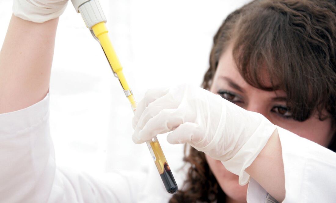 Hasta ahora no se ha detectado peligrosa variante de viruela símica en Puebla | EsImagen