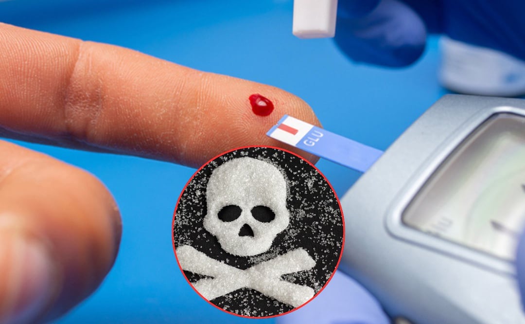 La diabetes está matando a cada vez más poblanos | Foto: Freepik/UNAM