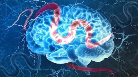 ¿México será el primer país en erradicar la cisticercosis? La UNAM cree que sí