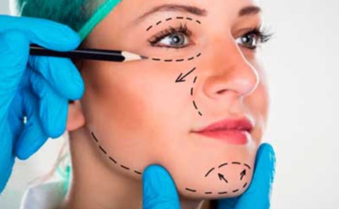 Cómo saber si un cirujano estético en Puebla es certificado y cuánto cobra I Foto: Pixabay