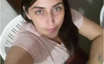 Mujer pierde el cartílago de su nariz luego de realizarse un hisopado contra el Covid-19