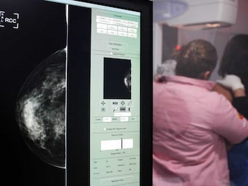 Mes rosa. Una mastografía puede salvar tu vida, aquí te decimos dónde acudir