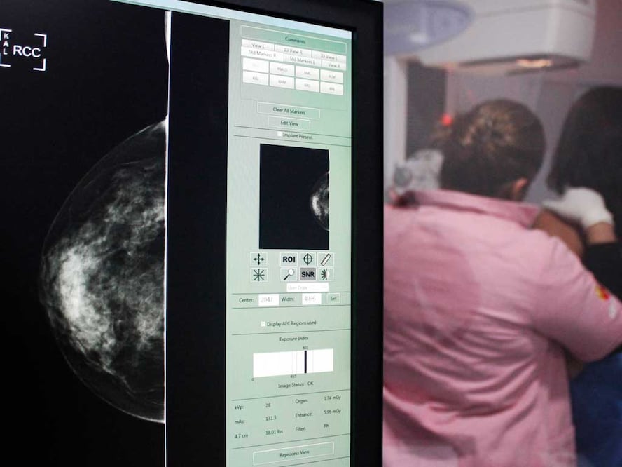 Foto: Agencia Es Imagen para El Universal Puebla