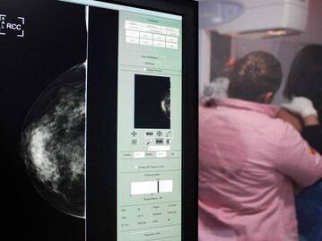 Mes rosa. Una mastografía puede salvar tu vida, aquí te decimos dónde acudir