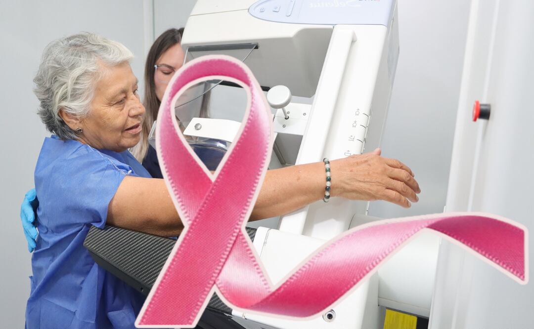 Alerta en Puebla por incremento del 4.5% de casos de cáncer de mama I Foto: EsImagen