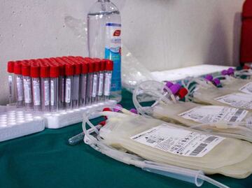 Buscan que donación de plasma pueda compensarse económicamente en México