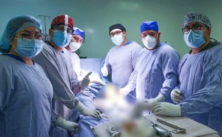 Cirugías gratuitas transforman vida de tres poblanos en el Hospital de Traumatología