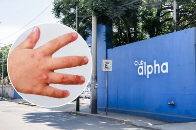 Salud confirma 11 casos de virus coxsackie en club Alpha 3
