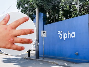 Salud confirma 11 casos de virus coxsackie en club Alpha 3