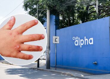 Salud confirma 11 casos de virus coxsackie en club Alpha 3