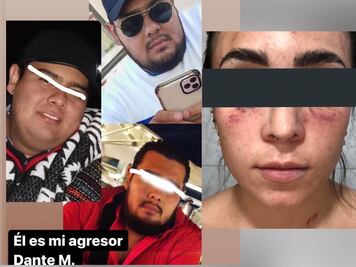 Hermano de candidata de RSP en Tlaxcala golpeó a joven embarazada, el feto está en riesgo