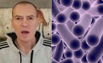 Cuáles son los síntomas de los divertículos estomacales que enfermaron a André Marín