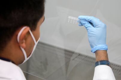 Variante Lambda no es de preocupación, asegura la Secretaría de Salud Puebla