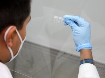 Variante Lambda no es de preocupación, asegura la Secretaría de Salud Puebla