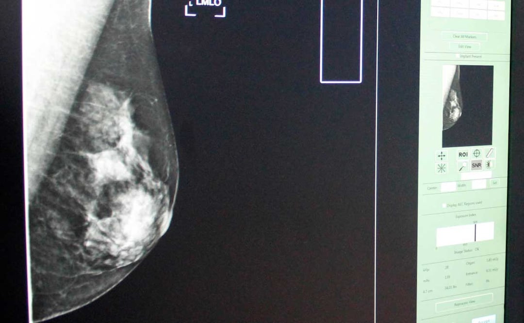 Foto: Agencia Es Imagen para El Universal Puebla