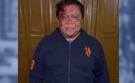 Golpean a Gonzalo Juárez, líder sindical del Ayuntamiento de Puebla