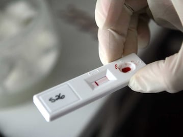 Puebla, sexto lugar nacional en número de pacientes con VIH