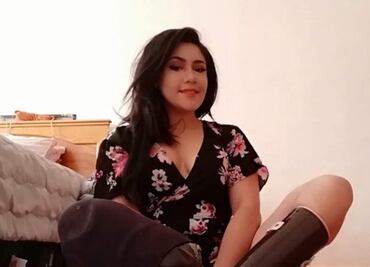 IMSS atiende recomendación en caso de mujer que le amputaron las piernas; reconoce compensación