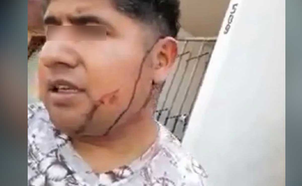 Autoridades niegan atención a  cuentahabiente tras asalto en Tepeaca