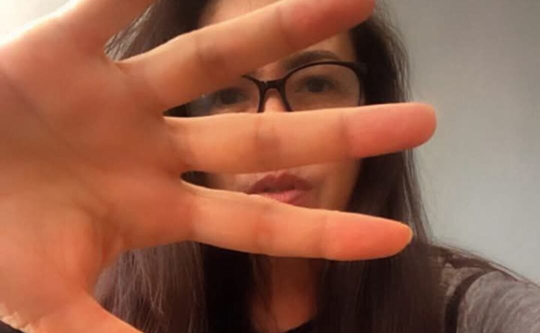 Yolanda Andrade al parecer tiene esclerosis múltiple | Foto: Facebook Yolanda Andrade