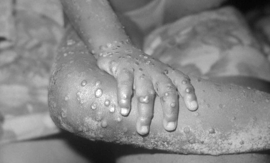 Foto: Archivo El Universal