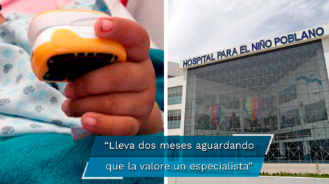 Alexa sigue esperando su tercera cirugía y solo hay un neurocirujano que no se da abasto