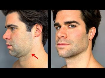 ¿Qué es el mewing?: La nueva tendencia en TikTok con la cual los jóvenes cambian la forma de su rostro