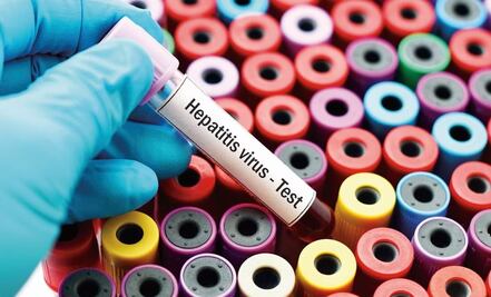 Surge brote de hepatitis A en Xochitlán de Vicente Suárez