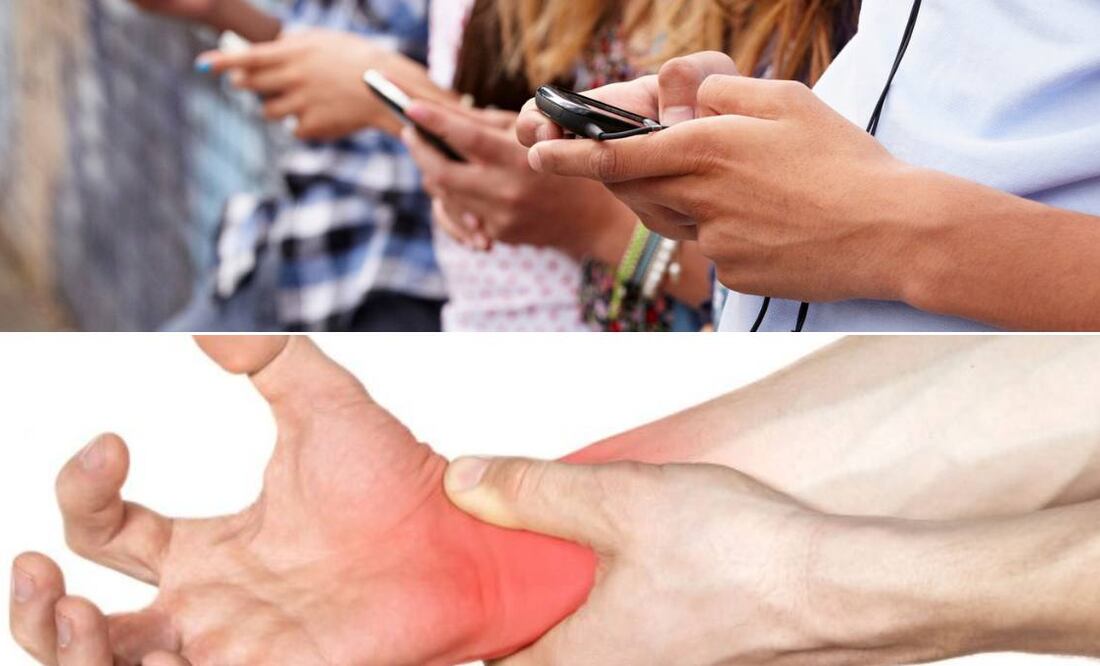 El síndrome del túnel carpiano es una neuropatía | Foto: Pixabay