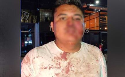 Empleados de Beirut de la Juárez golpean a clientes